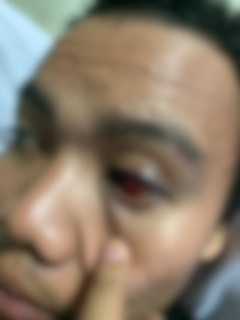 Potret korban mengalami cedera, (Foto: Ist)